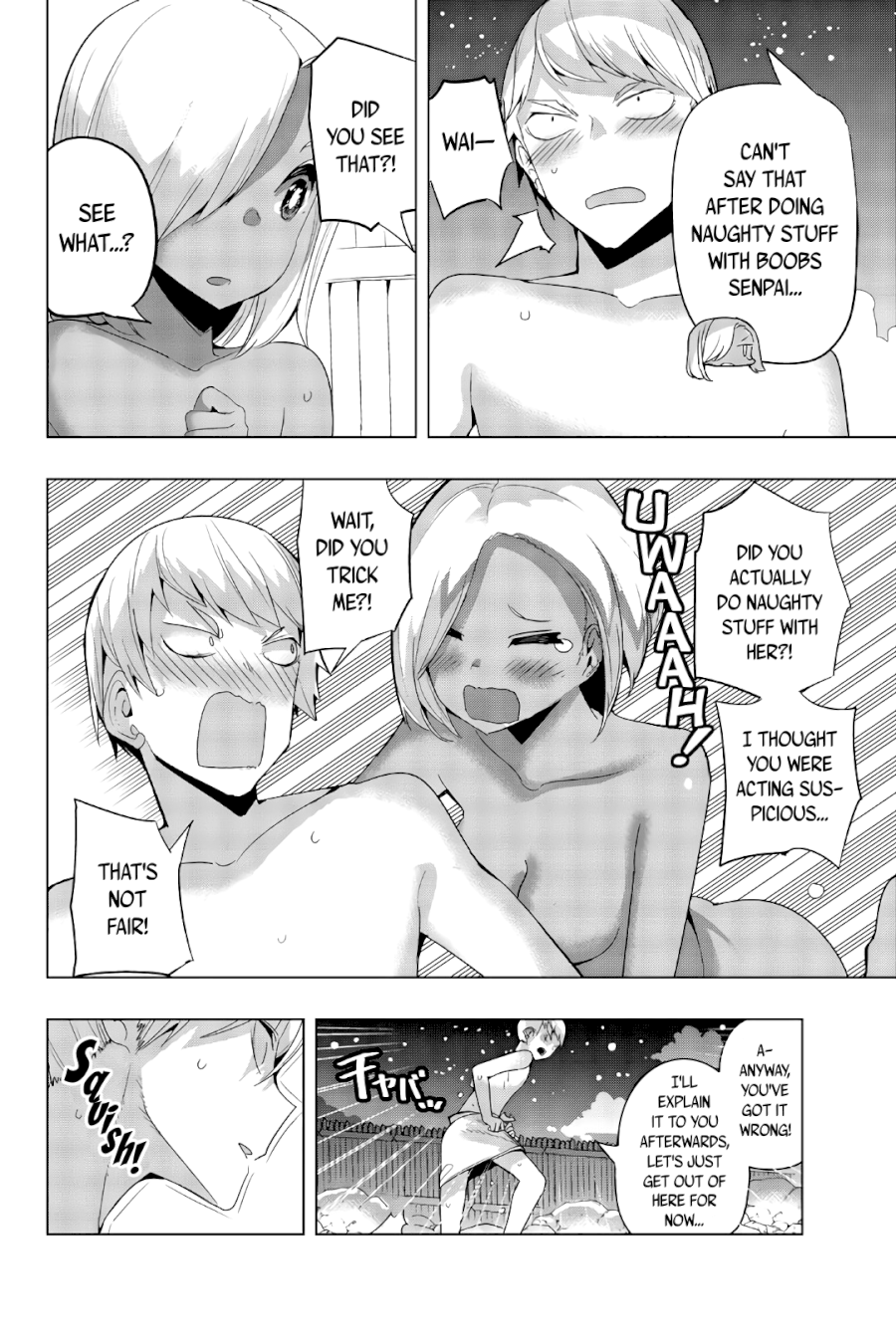 Houkago no Goumon Shoujo Chapter 47: Third In A Day…♥ Page 4